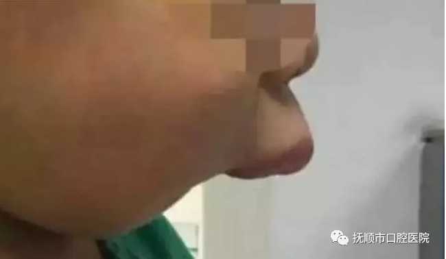 blob.png blob.png
